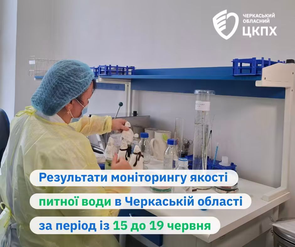 Лаборант досліджує проби питної води у лабораторії Черкаського обласного центру контролю та профілактики хвороб